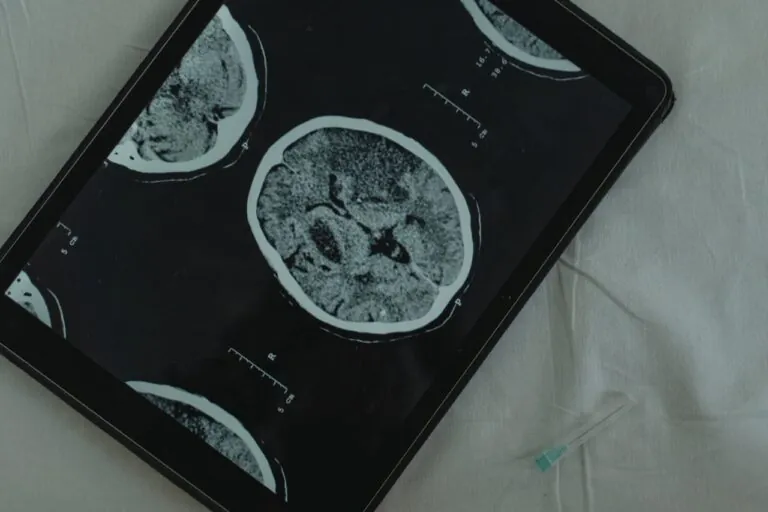 Beyin Cerrahisinde Yeni Teknolojiler: Neler Bilmeliyiz?