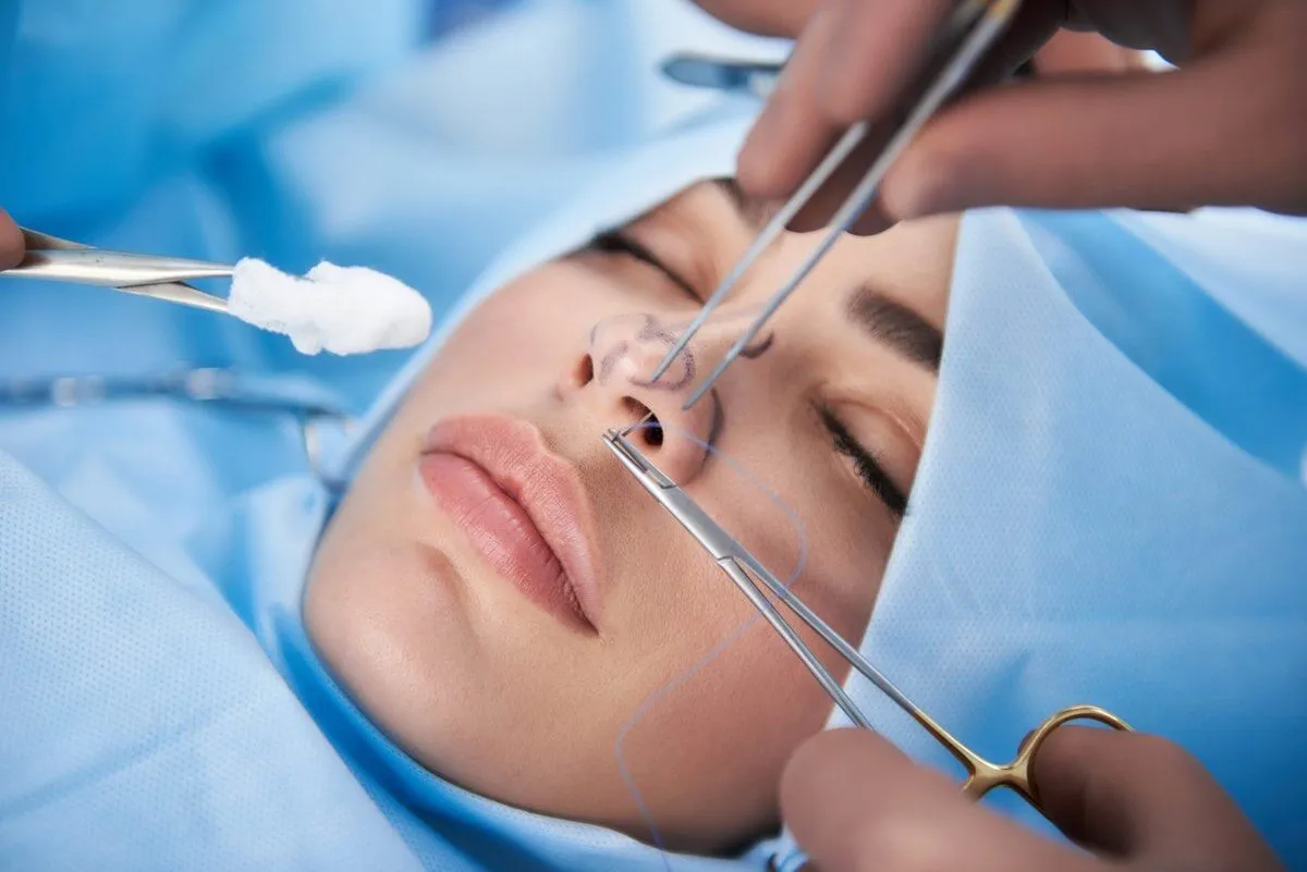 What Percentage of Nose Jobs is Successful scaled 1