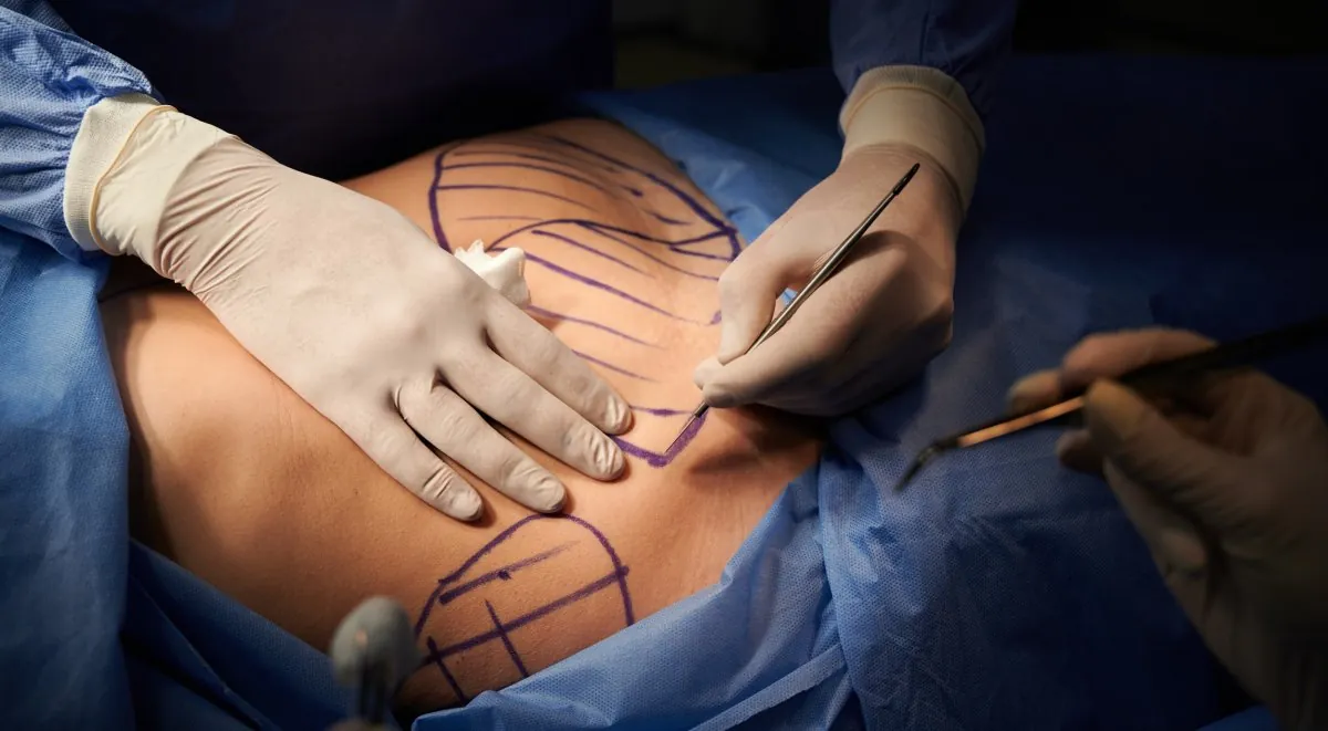 plastic surgery