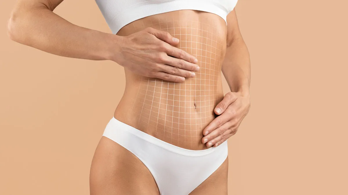 Karın Germe Ameliyatında İz Kalır mı? İzler Nasıl Azalır? 4 how much is a tummy tuck indy plastic