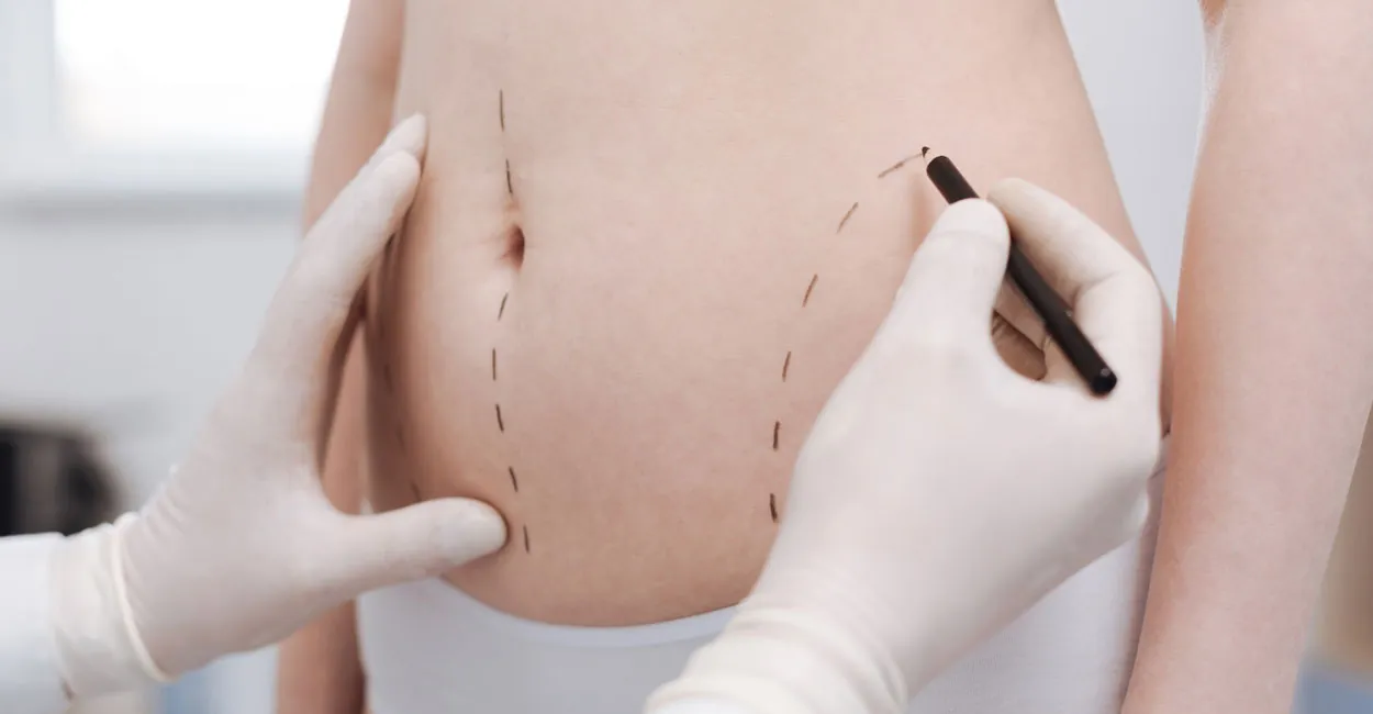 liposuction ile diyet arasındaki farklar