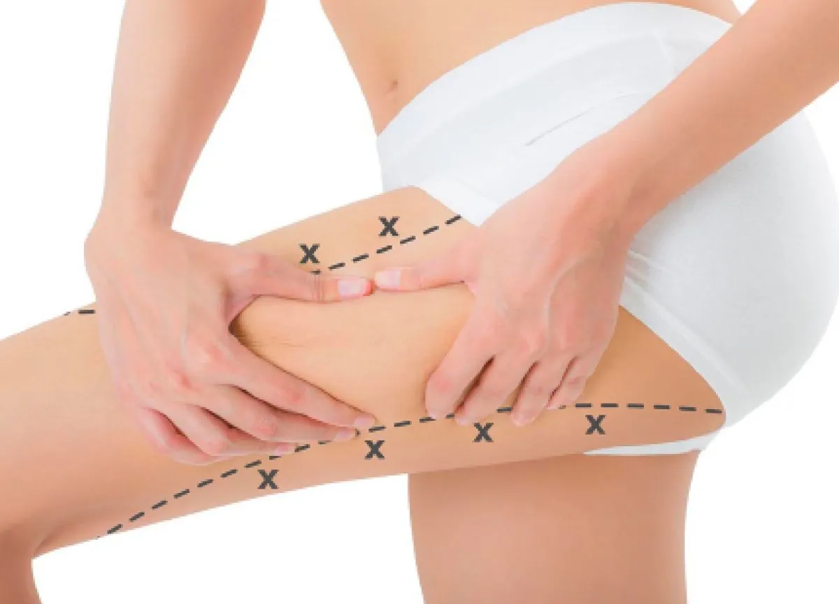 lipo3 365