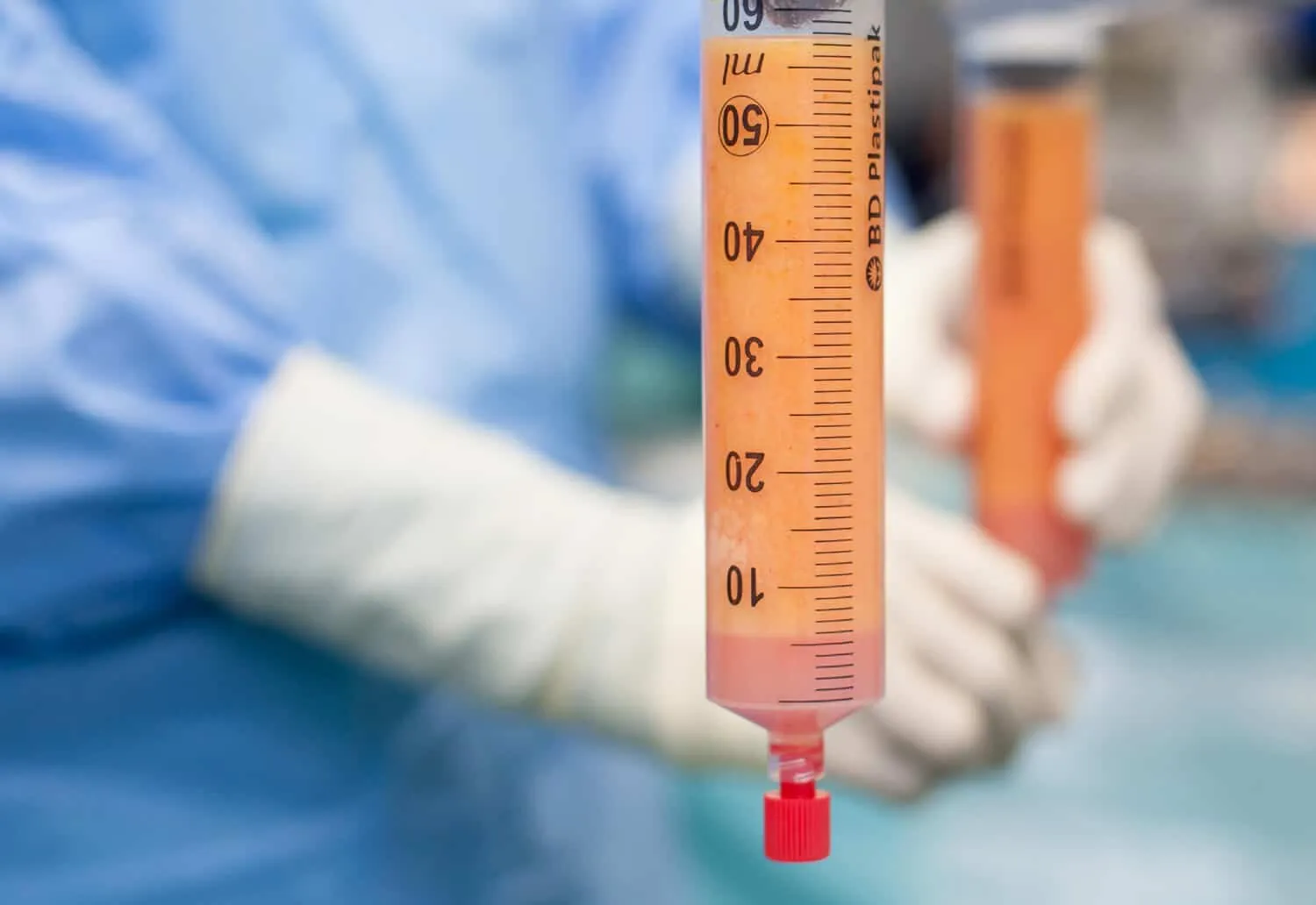 liposuction ile kac kilo yag alinir