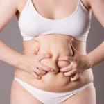 Karın Germe Ameliyatı Öncesi ve Sonrasında Nelere Dikkat Edilmelidir?