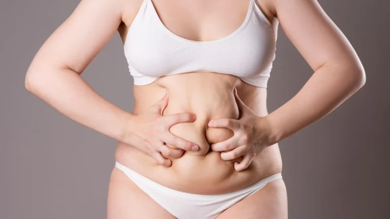 Karın Germe Ameliyatı Öncesi ve Sonrasında Nelere Dikkat Edilmelidir?