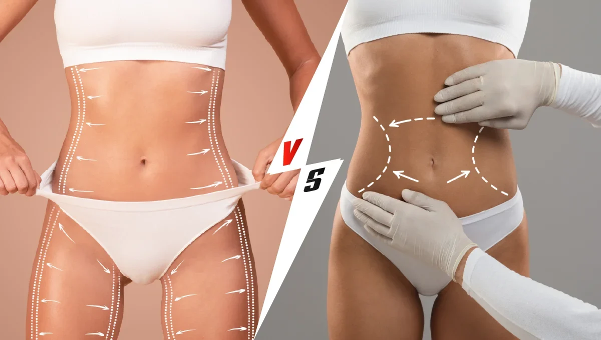 Liposuction Sonrası Kilo Alınırsa Ne Olur? Zararlı mıdır? 1 Liposuction Sonrası Kilo Alınırsa Ne Olur? Zararlı mıdır?