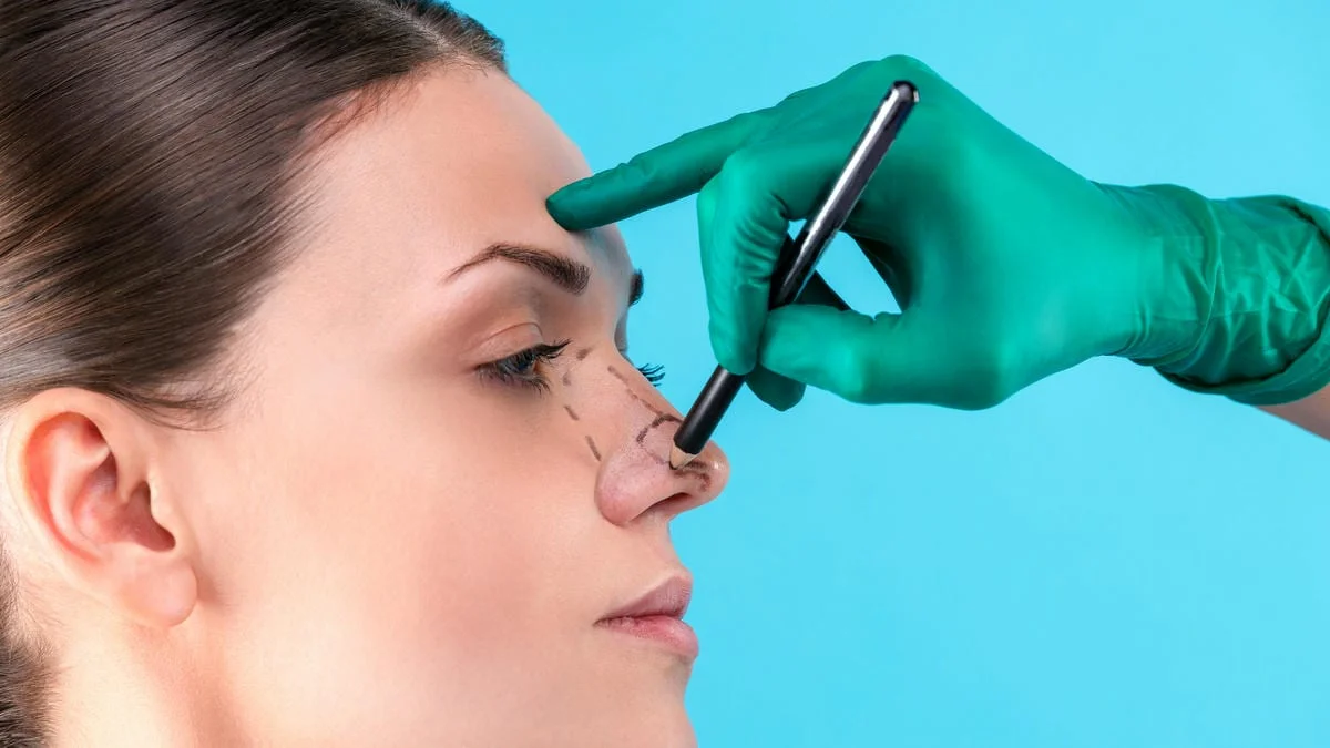 RINOPLASTI AMELIYATI YASAM HAST 2 comp2