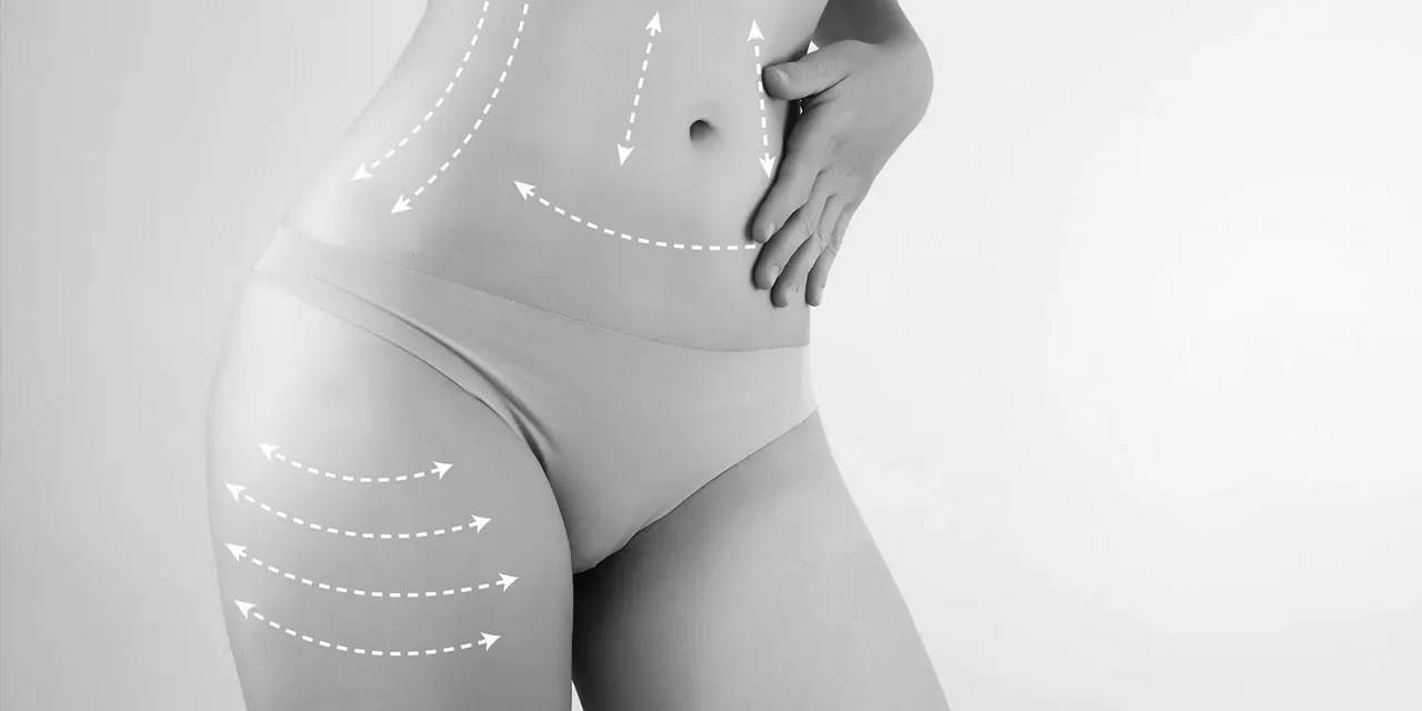 Liposuction Sonrası Kilo Alınırsa Ne Olur? Zararlı mıdır? 3 curiosities about liposuction