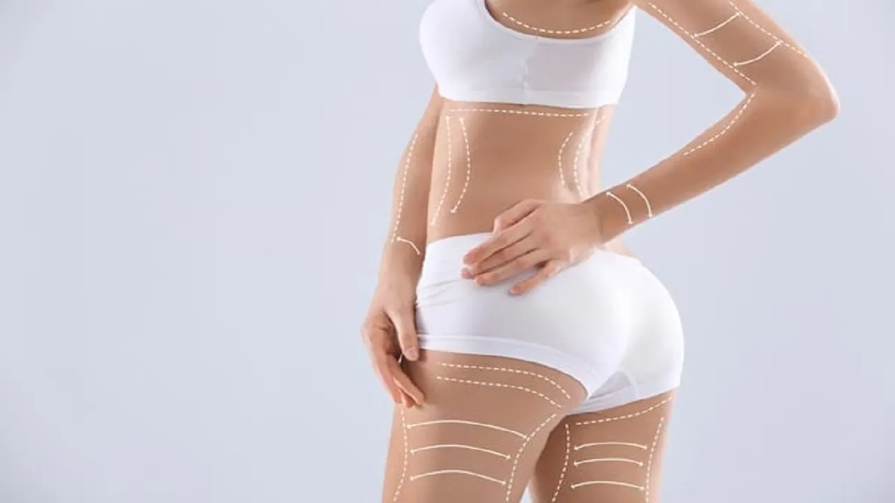Liposuction Sonrası Kalıcı Sonuçlar İçin Ne Yapmalısınız? Beslenme, Spor ve Takip Rehberi 5 37385 77735