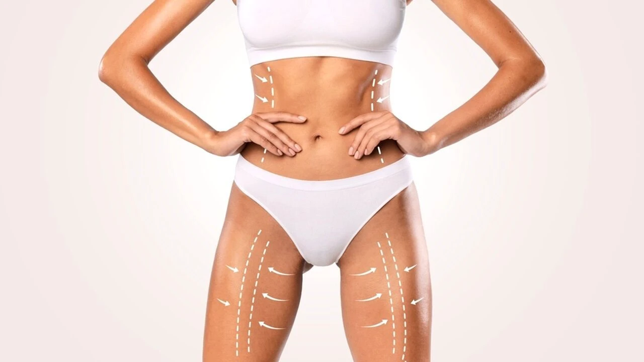 Liposuction Sonrası Kalıcı Sonuçlar İçin Ne Yapmalısınız? Beslenme, Spor ve Takip Rehberi 3 sariyer sposta