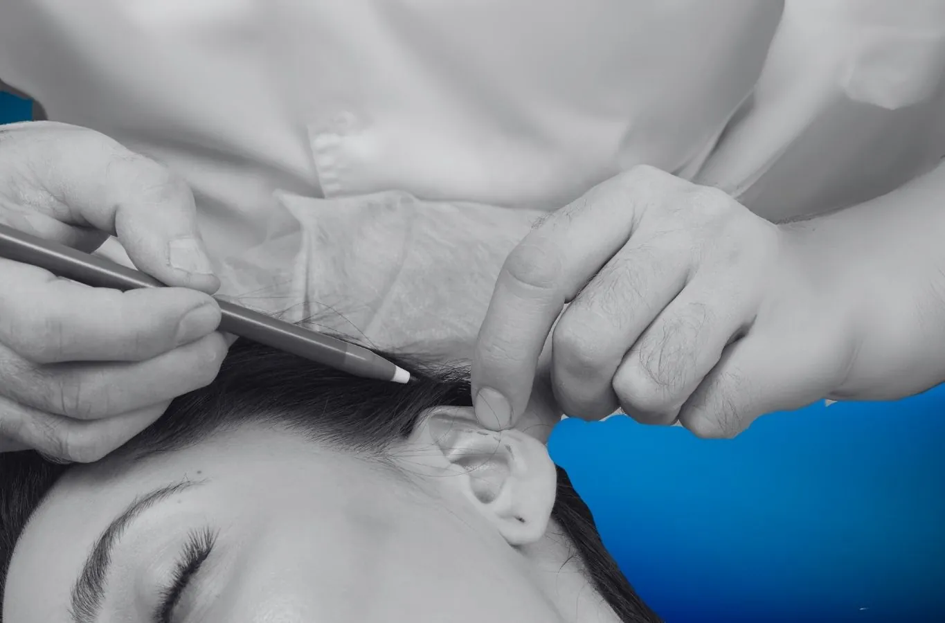 Kepçe Kulak Estetiği (Otoplasti) Nedir? Çocuk ve Yetişkinde Süreç Farkları 4 50